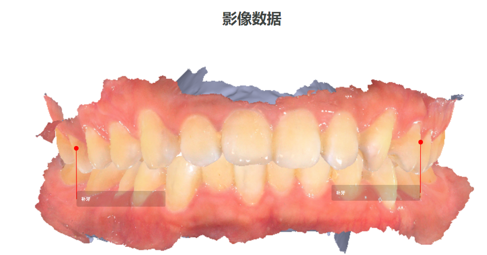 口腔病例识别