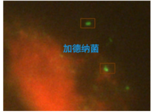 微生物菌类识别算法