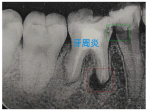 X光病症识别